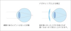 farsight