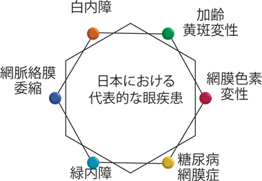 日本における代表的な眼疾患