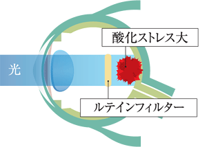 一般的なレンズを装用した眼